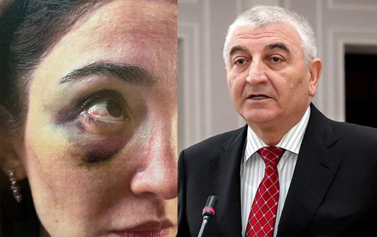 Keçmiş gəlinindən Məzahir Pənahova İTTİHAM: "Ona nüfuz önəmli deyil, zinət əşyalarımı qaytarmırlar"