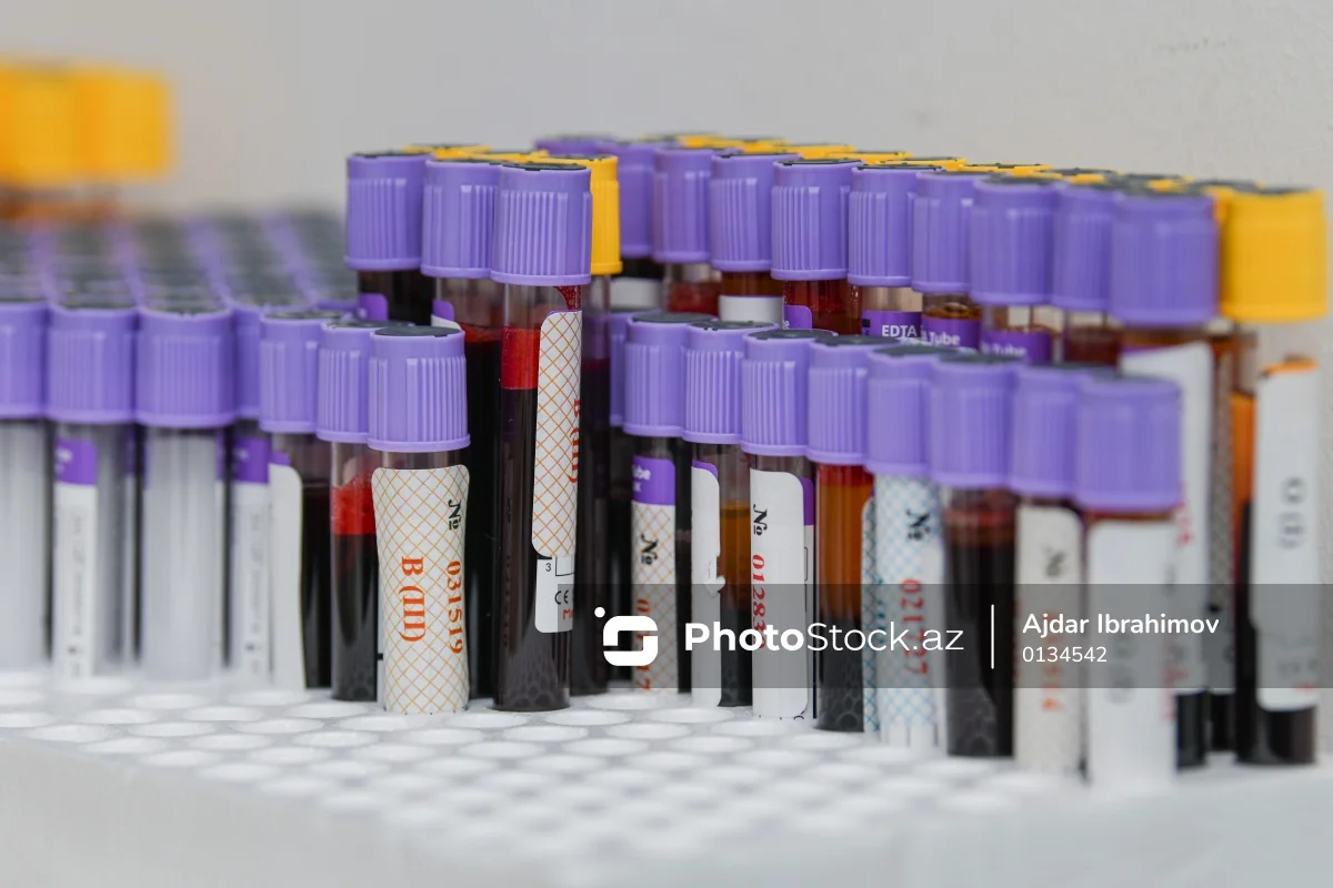 Evlənmək istəyən 700-dən çox şəxsdə talassemiya daşıyıcılığı aşkarlandı