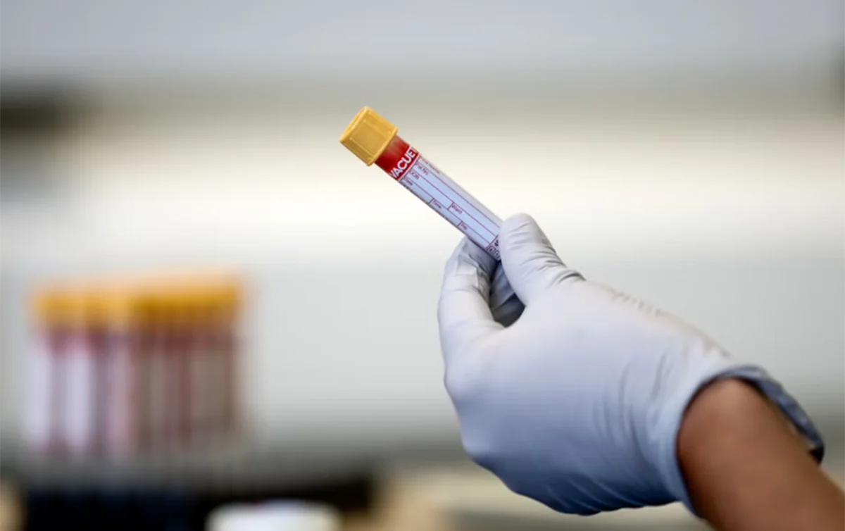 Nikahdan əvvəl narkotest tələbi və reallıqlar: Mütəxəssislər nə düşünürlər? - FOTO